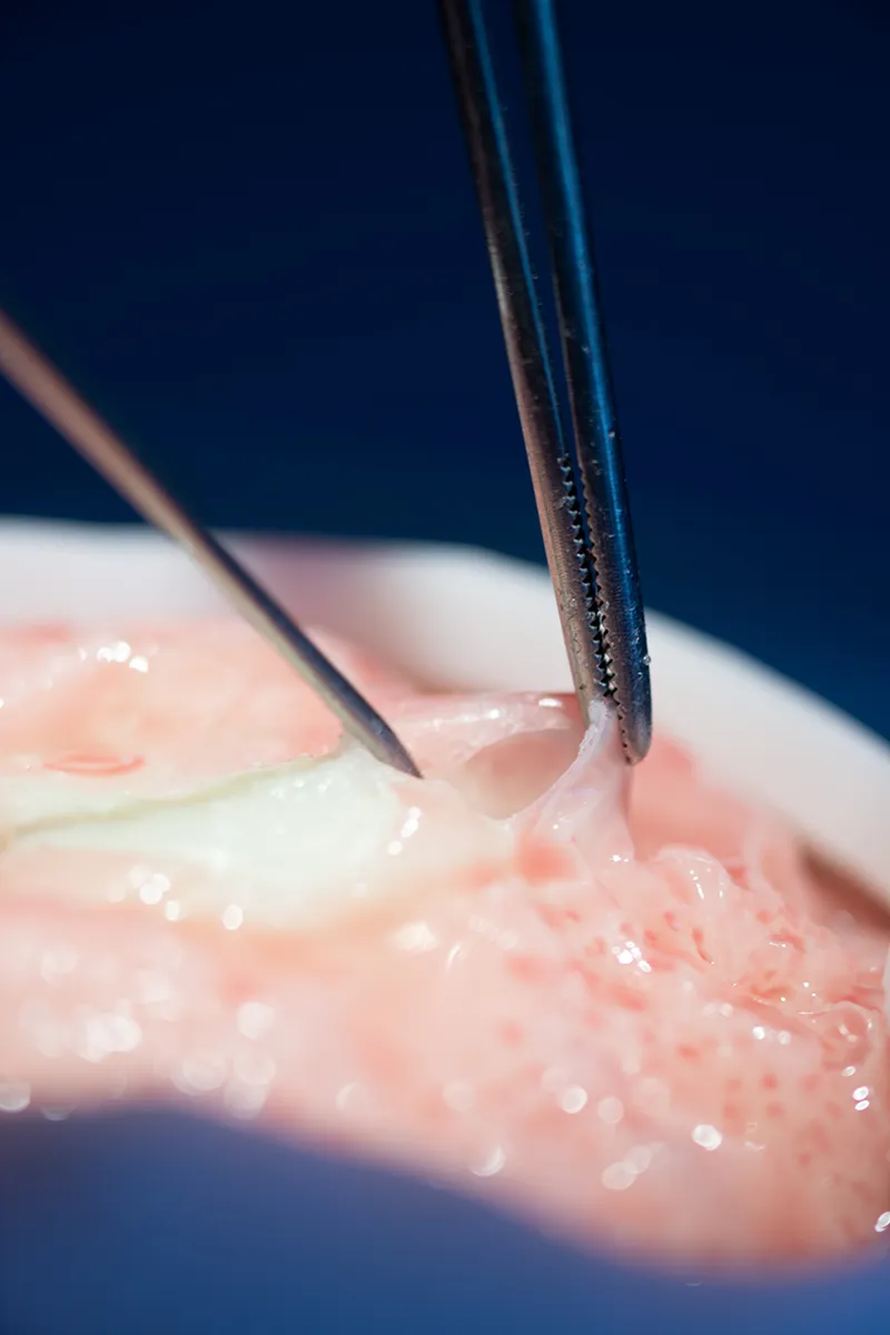 huvant besta neuro sim
